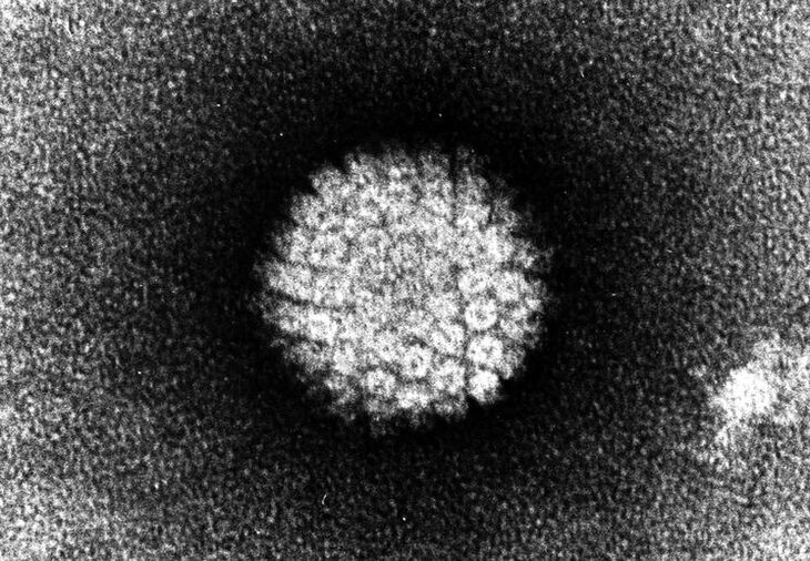 Humanes Papillomavirus, das Hautläsionen verursacht