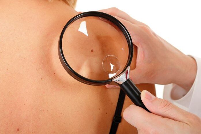 Untersuchung eines Patienten mit HPV.